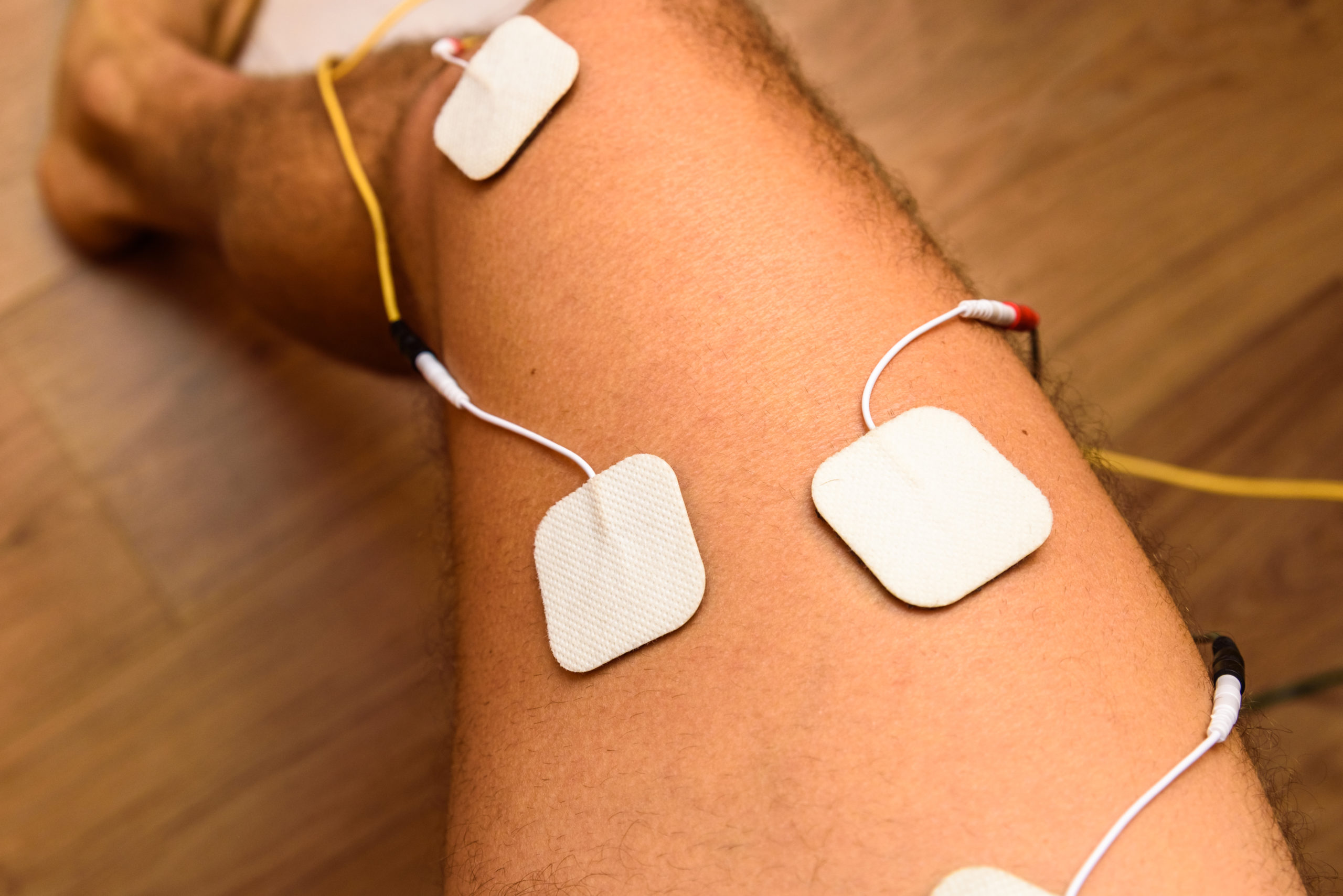 An injured athlete applies ems electrodes to his legs to recover muscle tone with a tensile electrostimulation system.